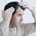 Turkish Treasures: Unlocking Hair Transplant Costs